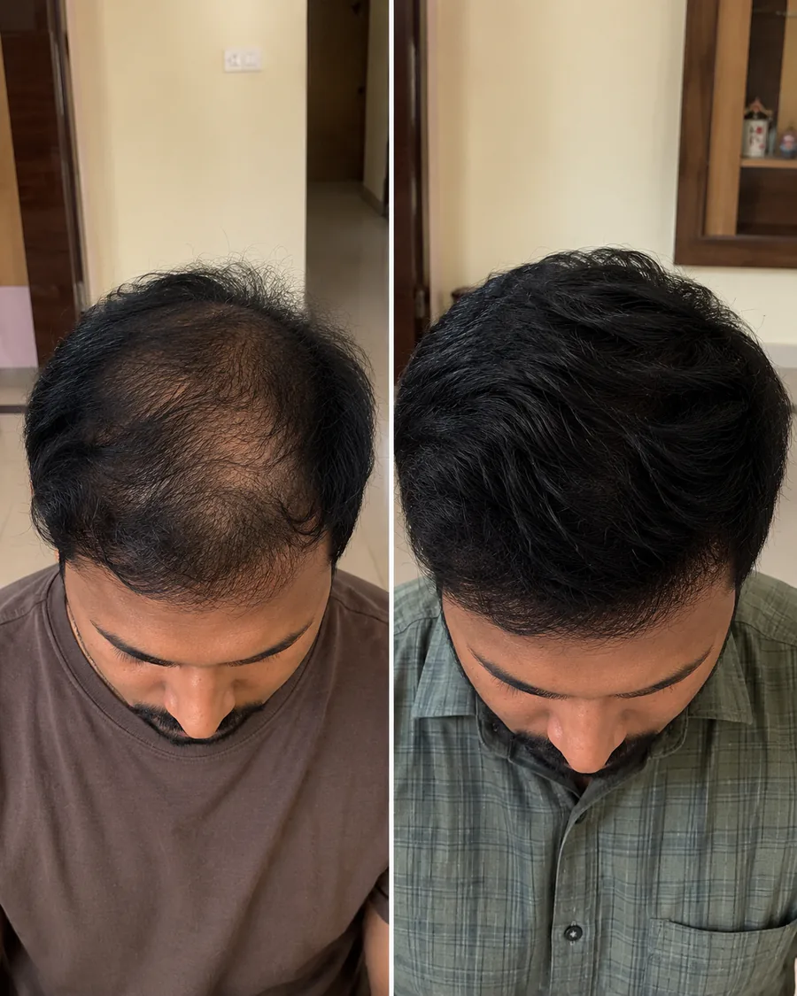 Raksiv Herbonics customer result 7