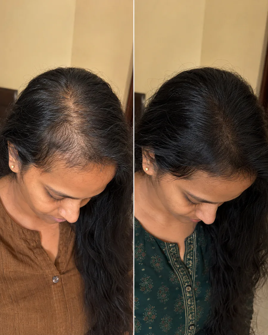 Raksiv Herbonics customer result
