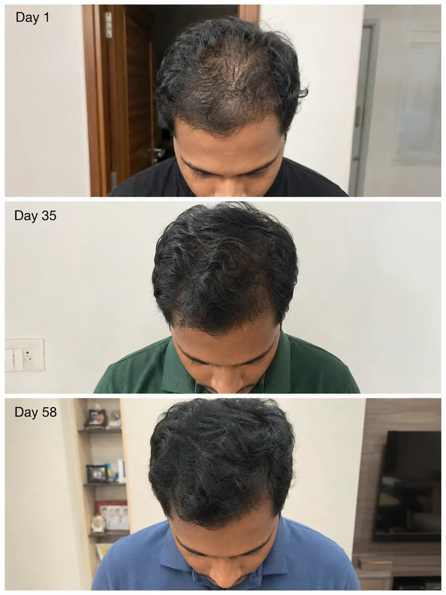 Raksiv Herbonics customer result