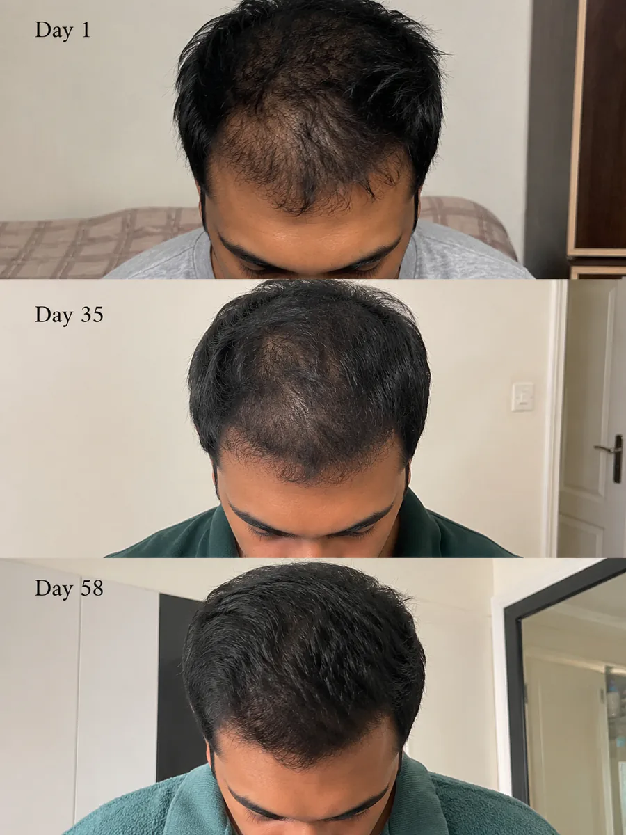 Raksiv Herbonics customer result